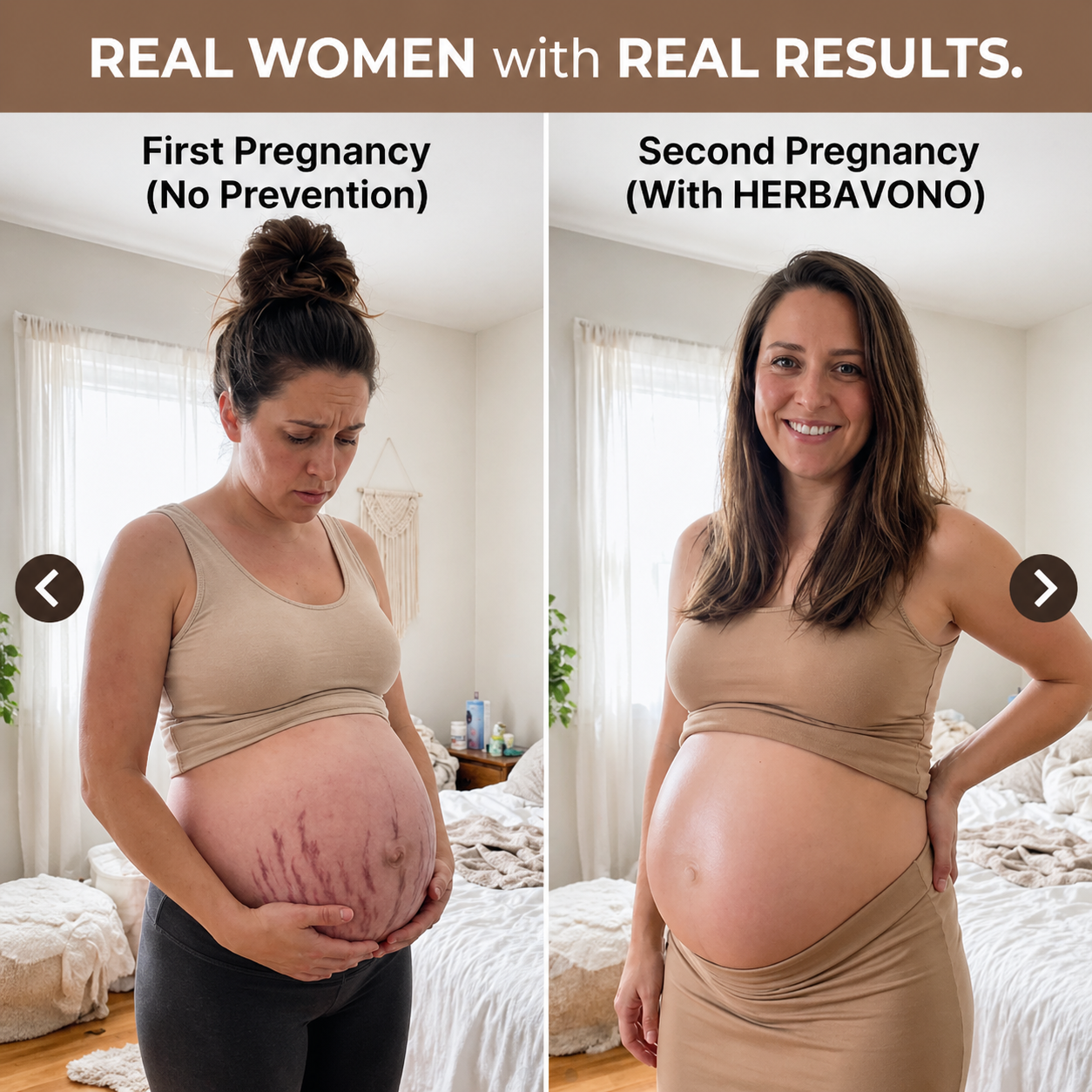 2-Step Stretch Mark Prevention Bundle