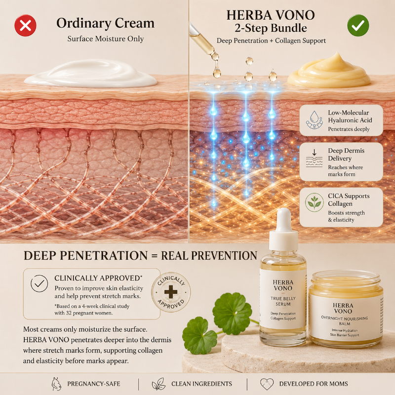 2-Step Stretch Mark Prevention Bundle