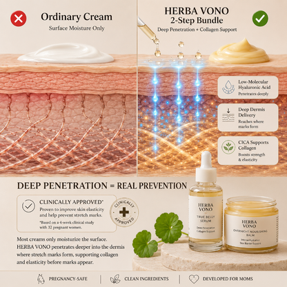 2-Step Stretch Mark Prevention Bundle